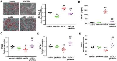 Contribution of adipocyte Na/K-ATPase α1/CD36 signaling induced exosome secretion in response to oxidized LDL